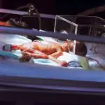 Visite de routine d'un bébé prématuré