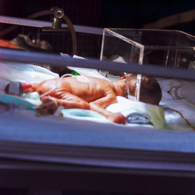 Visite de routine d'un bébé prématuré