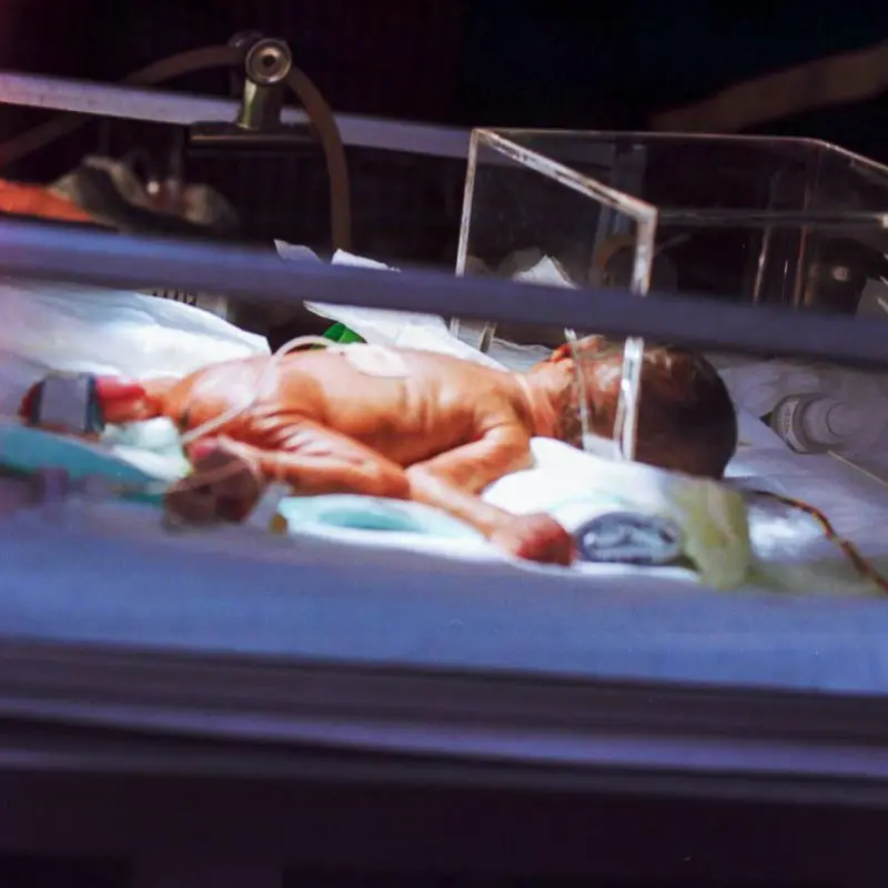 Visite de routine d'un bébé prématuré